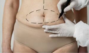 Mommy makeover surgery