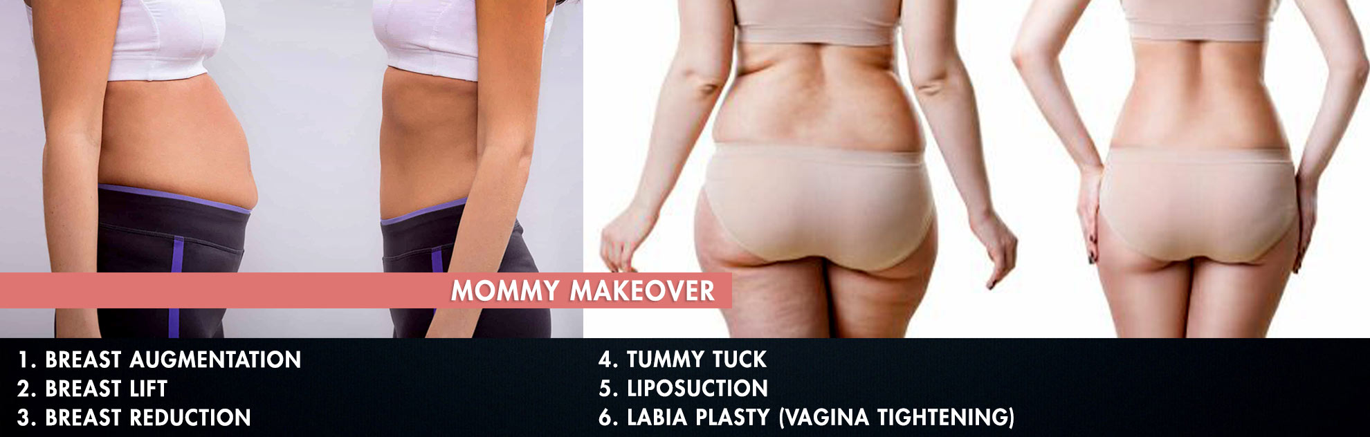 Mommy MakeOver Hyderabad