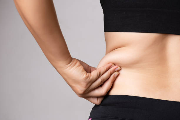 Liposuction Surgery for Female in Hyderabad