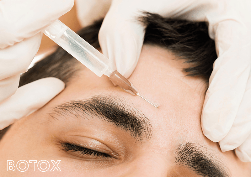 Male Botox Surgery in Hyderabad, India