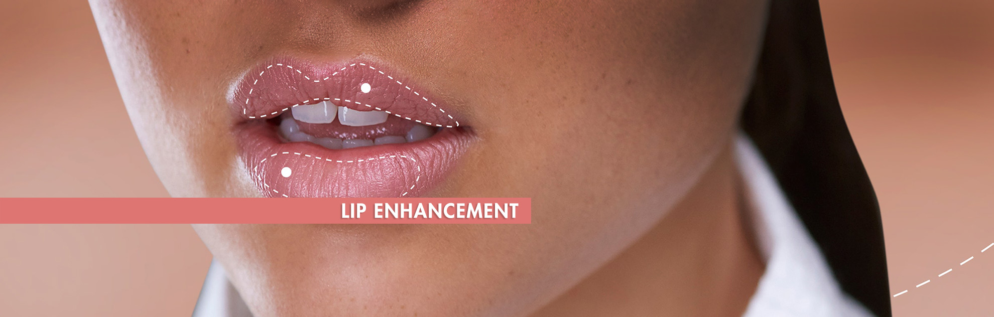lip enhancement surgery hyderabad