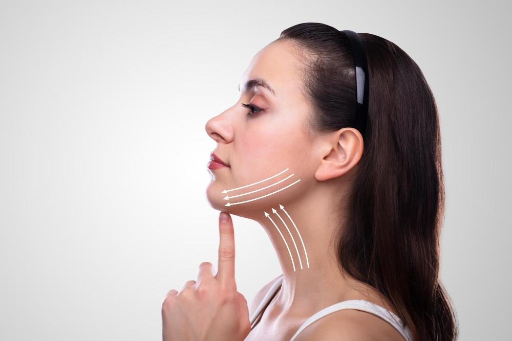 double chin correction treatments