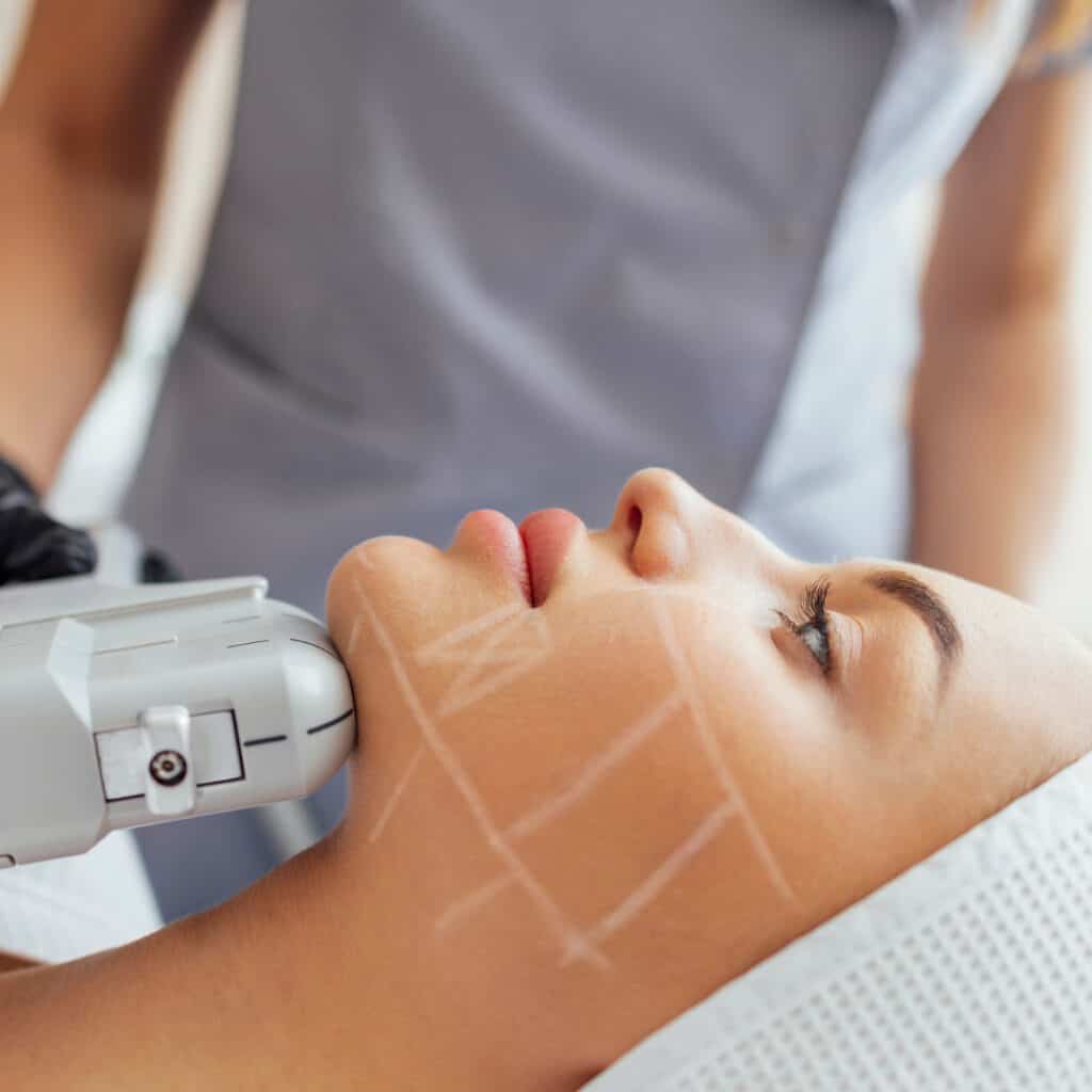Safe and effective radiofrequency skin tightening treatment to reduce wrinkles and sagging, enhancing skin's firmness and elasticity.