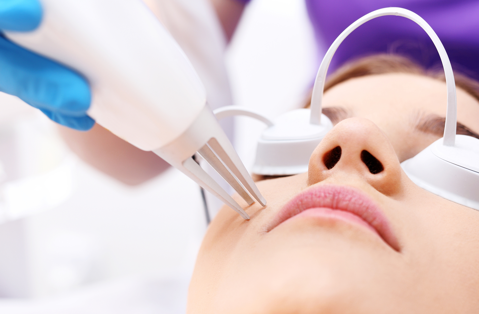 Precision laser acne treatment to reduce blemishes, prevent future breakouts, and enhance skin texture.