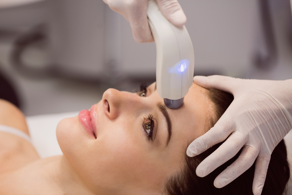 Non-invasive laser wrinkle reduction procedure designed to reduce wrinkles and restore skin’s natural glow.