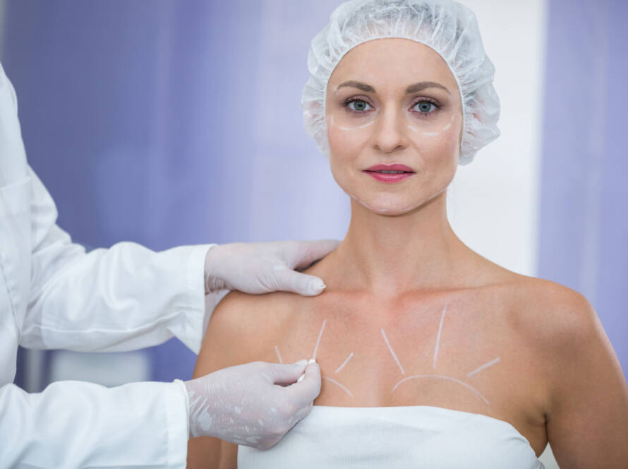 breast reduction surgery